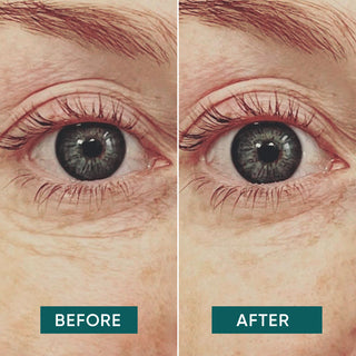 Ein Vorher-Nachher Vergleich der Augenpartie bei der Anwendung der Augenpads der Marke Apricot Beauty.